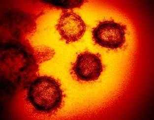 This undated electron microscope image made available by the U.S. National Institutes of Health in February 2020 shows the Novel Coronavirus SARS-CoV-2, the virus that causes COVID-19. (NIAID-RML via AP FILE)